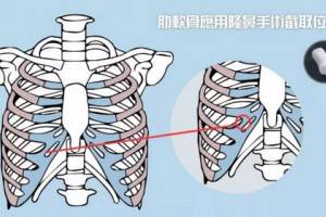 大学生整形调查：超3成想整，近9成不介意身边同学整