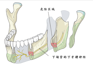 电波拉皮除皱手术功效适合哪些人