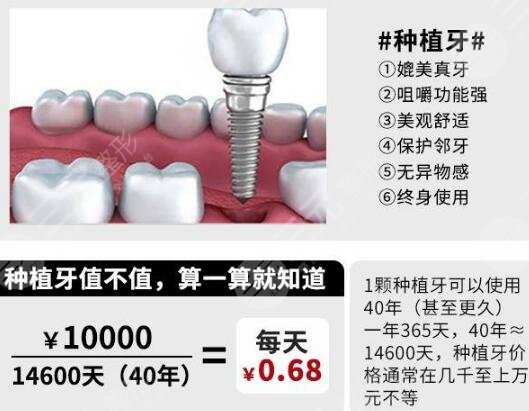 种植牙能用多久