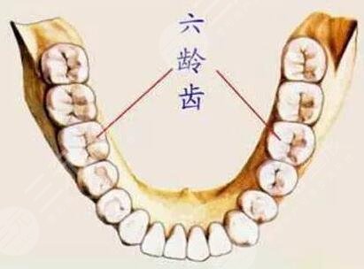 六龄齿窝沟封闭有必要吗