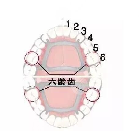 六龄齿窝沟封闭有必要吗