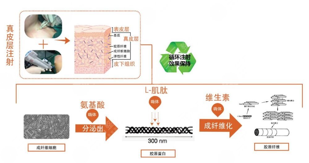 嗨体去颈纹多少钱一支