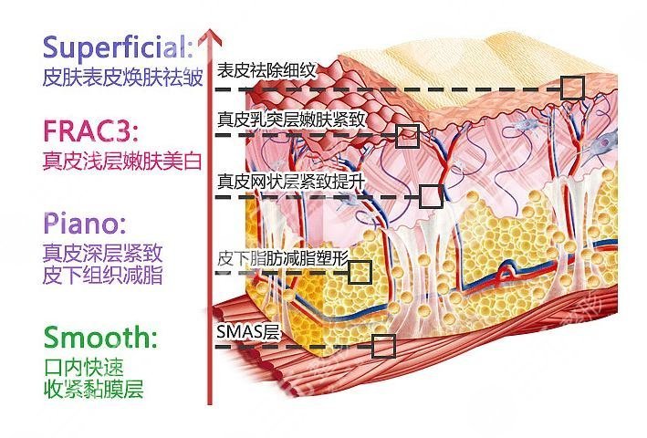 欧洲之星疼不疼