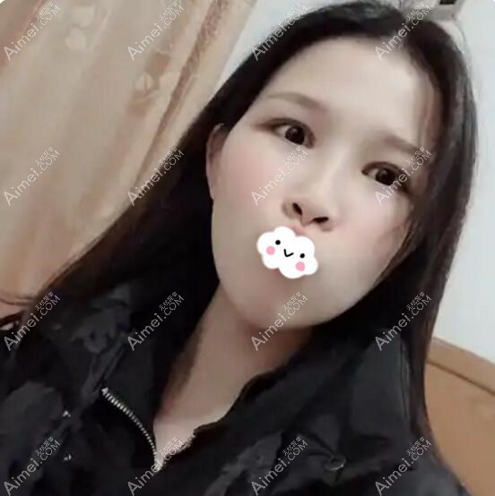 术后1年多