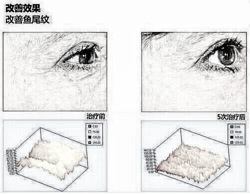 丽珠兰面部提升的强大功图，消散酷暑肌肤就靠