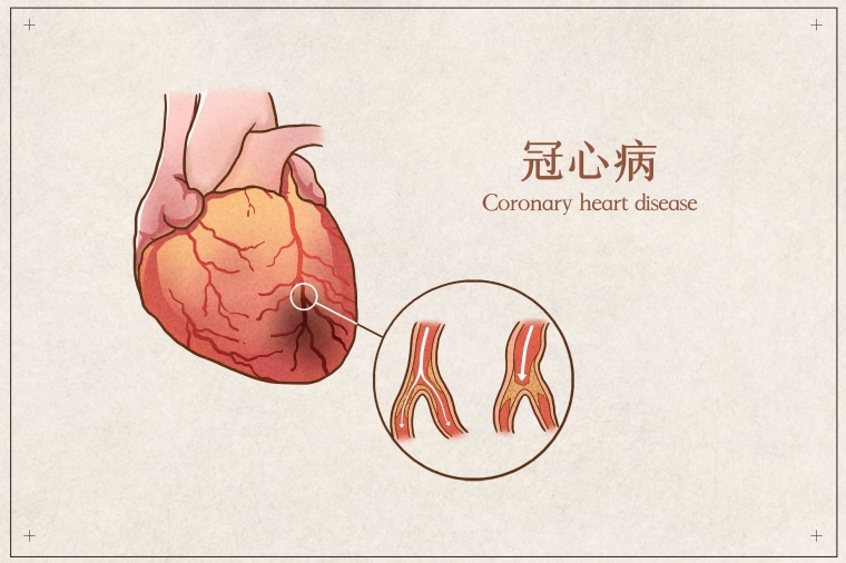 皱纹、松垂、凹陷，三大衰老症状，怎么解决？