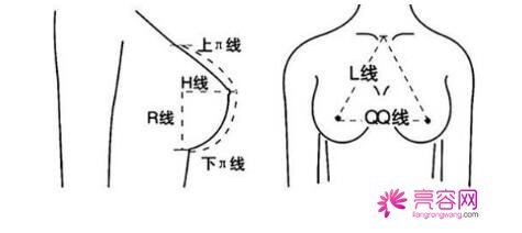 娜高假体隆胸果怎么样？内含真人丰胸全过程，术后身材性感迷人！