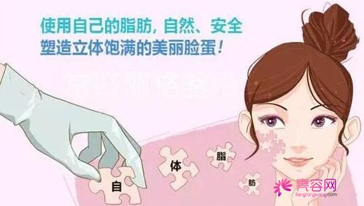 自体脂肪填充后遗症有哪些？要怎么避免这些情况呢？面部填充案例