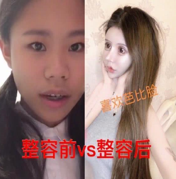 小Z娜的女网红过度整容引起热议 13岁开启整容不归路