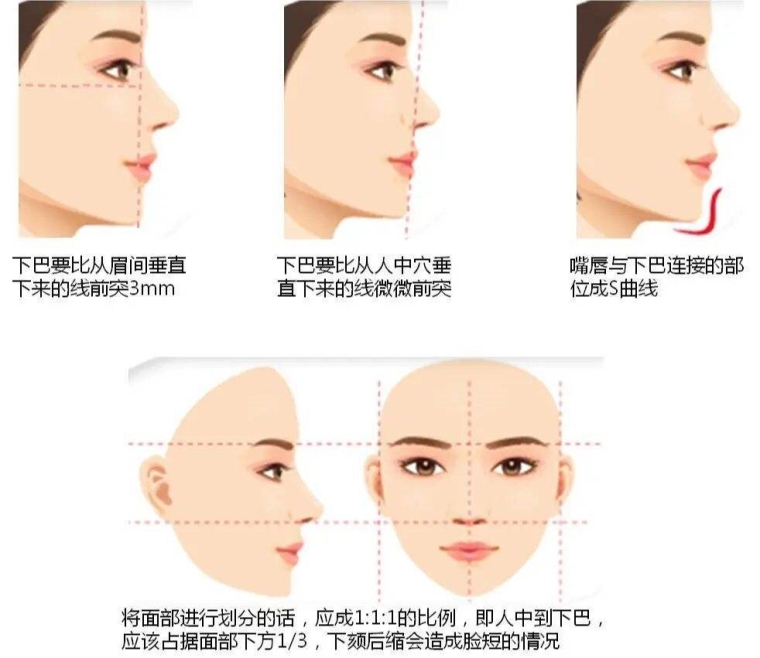 老医生给你说假体隆下巴费用要多少呢