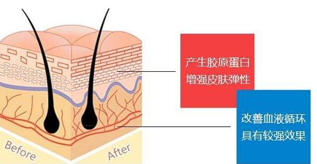 线雕近几年内为什么这么火?