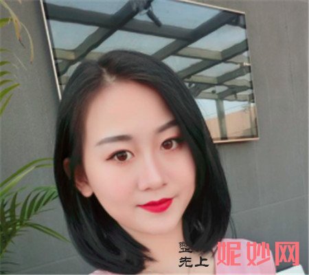 到北京画美医院找陈忠存做的厚唇改薄，术后四个月嘴唇精致又好看