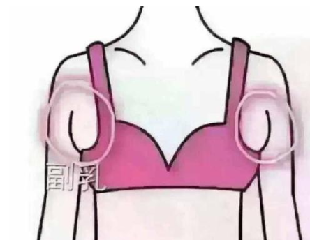 去副乳