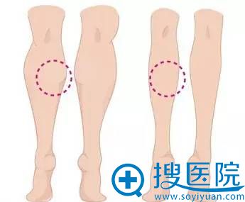 吸脂医院需要具备的资质