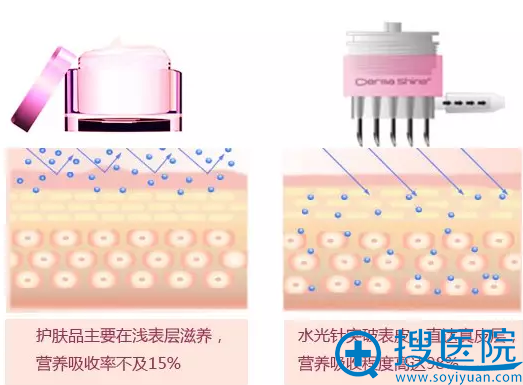 里的玻尿酸，和注射用玻尿酸有什么区别？