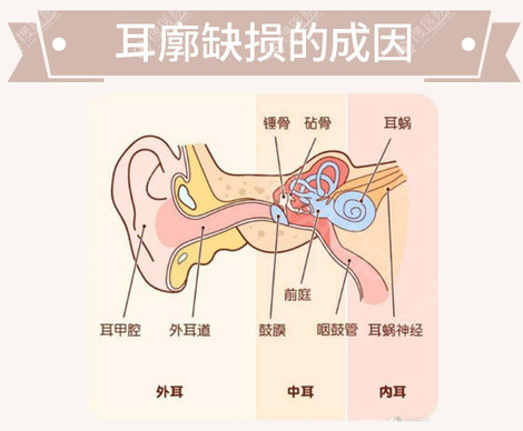 耳廓整形手术价格3万元起，推荐两位国内耳再造厉害的医生给你