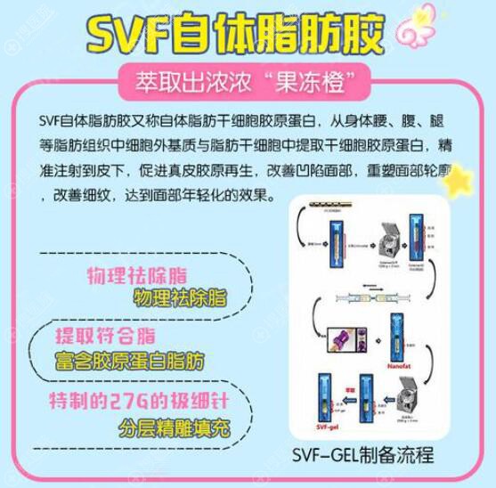 SVF脂肪胶原理