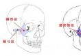 当有人吐槽做完颧骨手术后悔死了,你应该先了解原因及后遗症