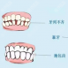 为什么牙齿矫正后悔一辈子?先来搞清楚正畸拔牙弊端和危害再说