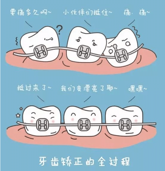 牙齿矫正的价格是多少 哪种方法比较好